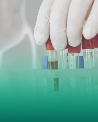 Myths about donating blood and tests